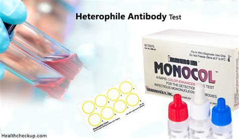 Heterophile antibody test